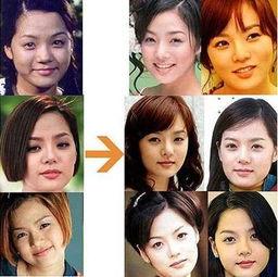 整容女明星失败照片